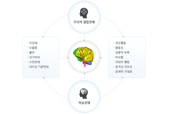 뉴로피드백 이미지2